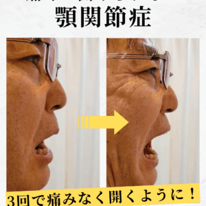 全身を整えて顎関節を改善する整体！