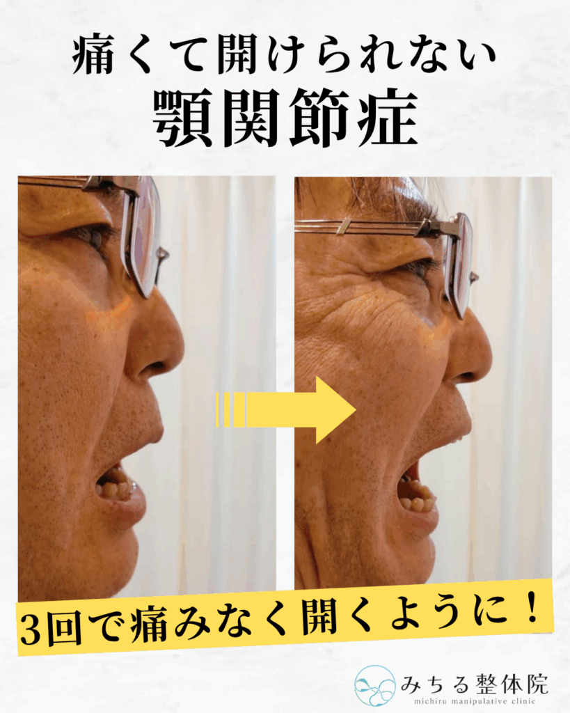 全身を整えて顎関節を改善する整体!