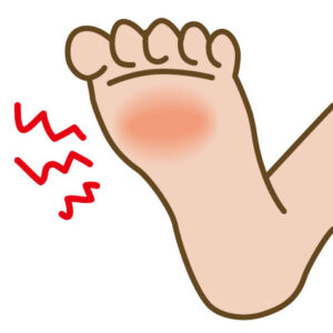 足底筋膜炎のメカニズム