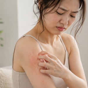 アトピーが整体で改善する理由｜自律神経・ストレス・睡眠から考える アトピー性皮膚炎と整体の関係